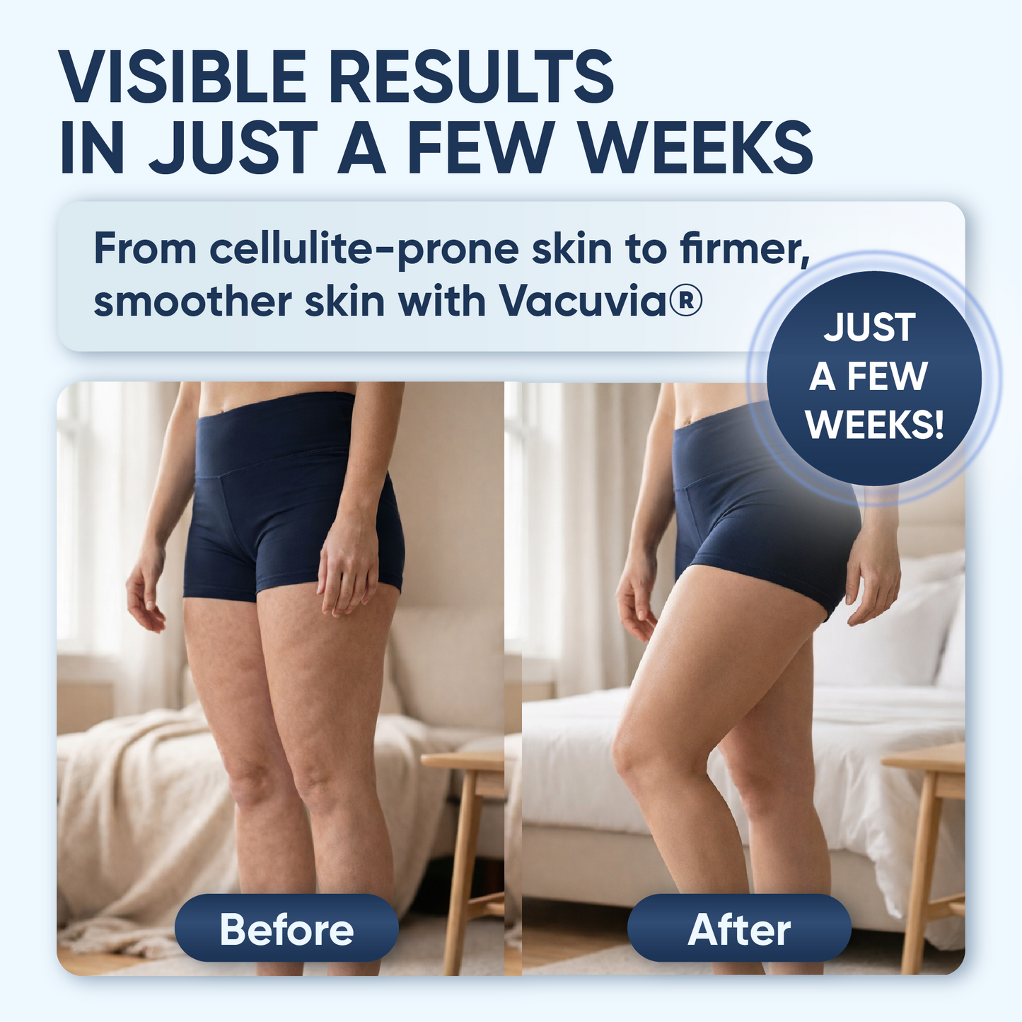 Vacuvia® SculptGlow™ – Firmer, More Toned Skin